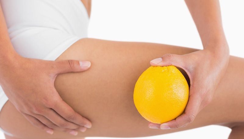 naranja celulitis