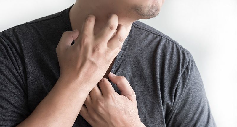 picazon en el cuello