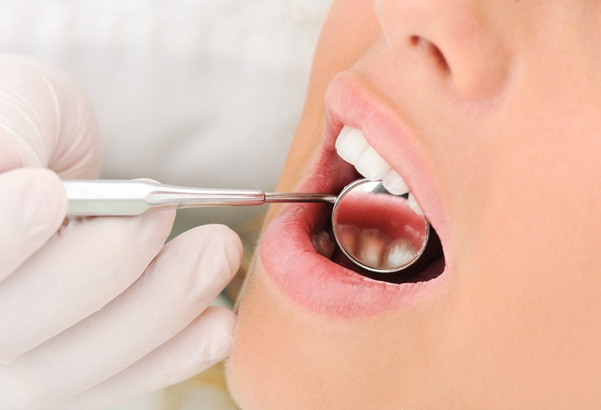 Gingivitis: cuidados para evitar el sangrado de encías
