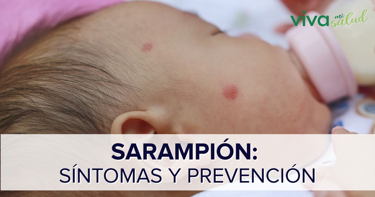 todo-lo-que-debes-saber-sobre-el-sarampi-n-y-su-prevenci-n
